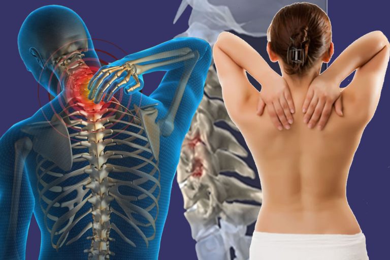 Posturas de Yoga contra la tensión cervical