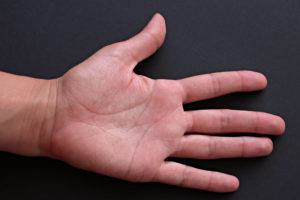 puntos marma de la mano
