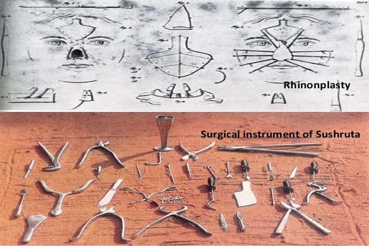 instrumentos quirúrgicos ayurvédicos